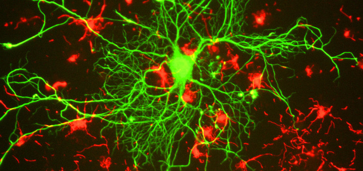 alzheimers cannabinoids 06 23 720x340